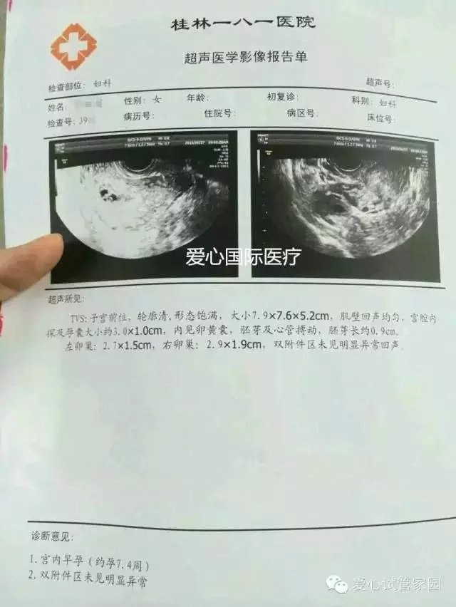 【全国各地的朋友都来报喜啦！！】赴泰试管验孕成功