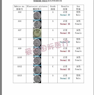 【爱医胚胎喜讯】多囊卵巢患者16个胚胎经23对染色体筛查 全部正常