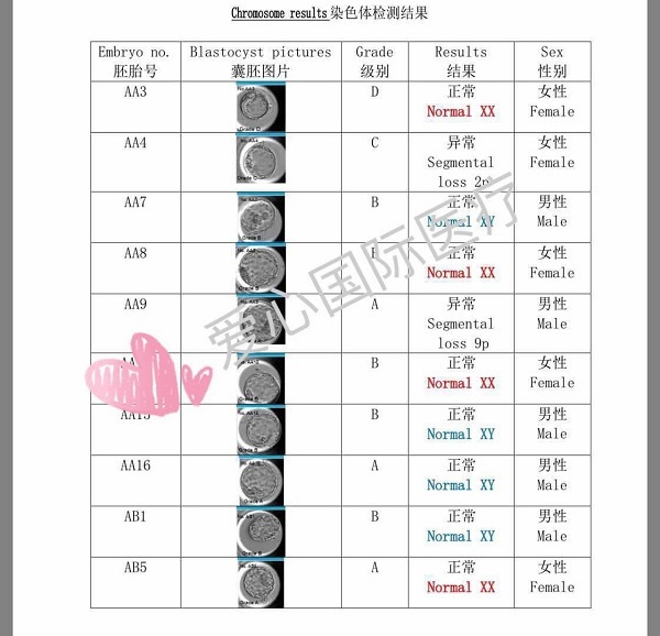 42岁卵巢衰退 泰国试管助梦 19个胚胎送检 16个正常