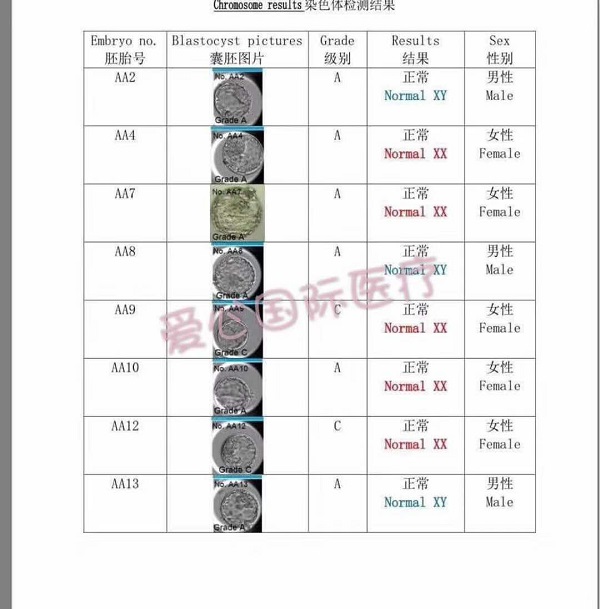 AMH0.22，子宫内膜薄，34岁卵巢早衰，泰国试管婴儿一次圆梦