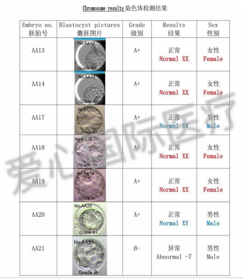 【泰国试管婴儿龙凤胎】32岁卵巢早衰AMH=0.3，选择试管圆梦龙凤胎