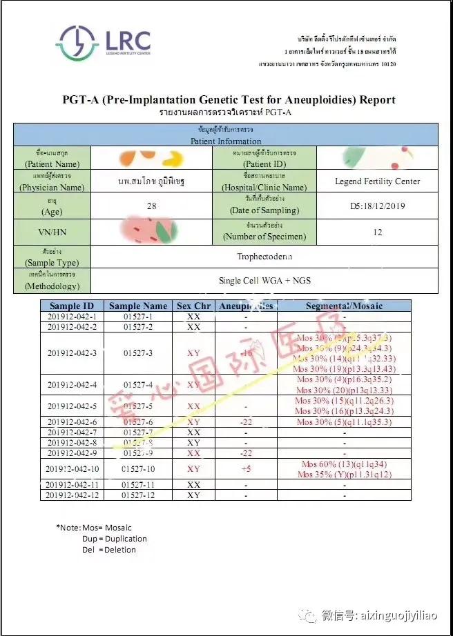 【泰国试管婴儿龙凤胎】28岁染色体异常反复胎停，赴泰试管一次成功