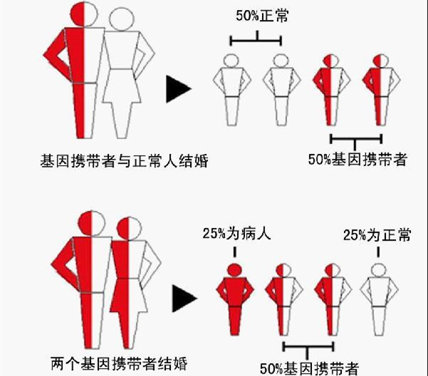 泰国第三代试管婴儿地中海贫血