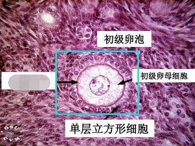 泰国第三代试管婴儿基础卵泡少