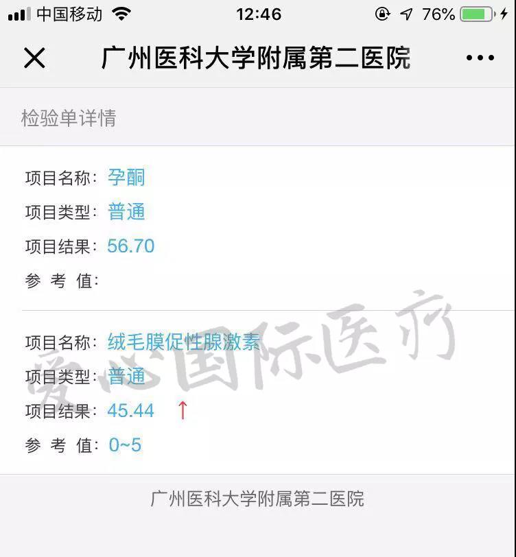泰国试管婴儿